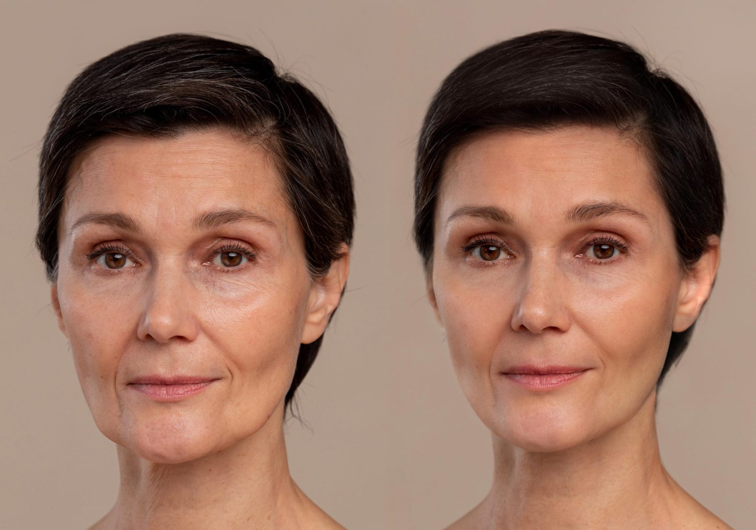 ¿Cuáles son los beneficios de un rejuvenecimiento facial?
