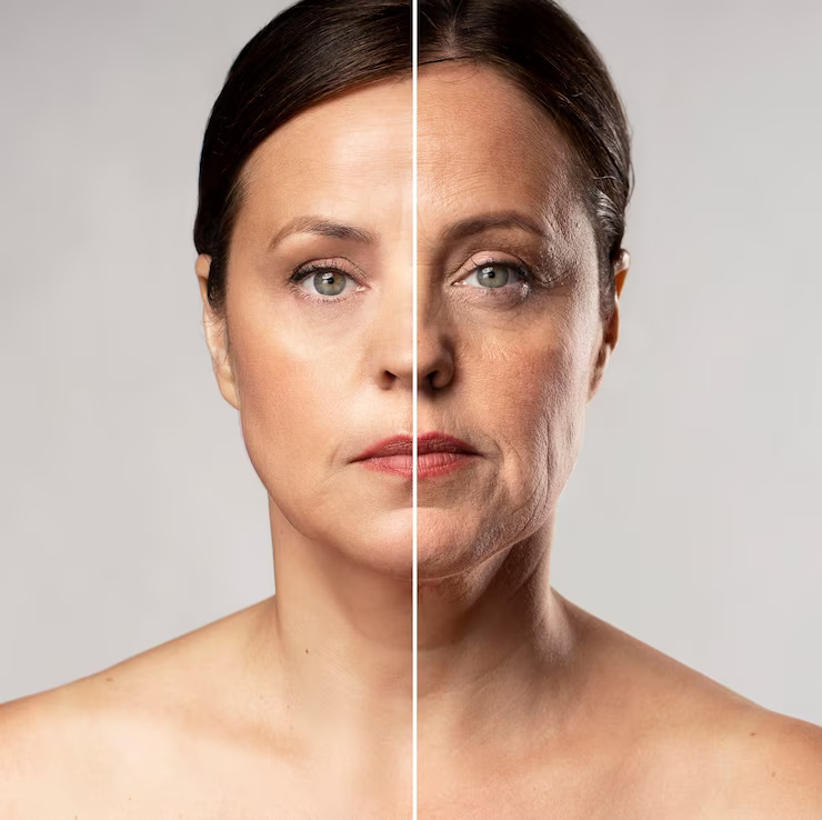 ¿Qué es una redefinición del óvalo facial y contorno mandibular: