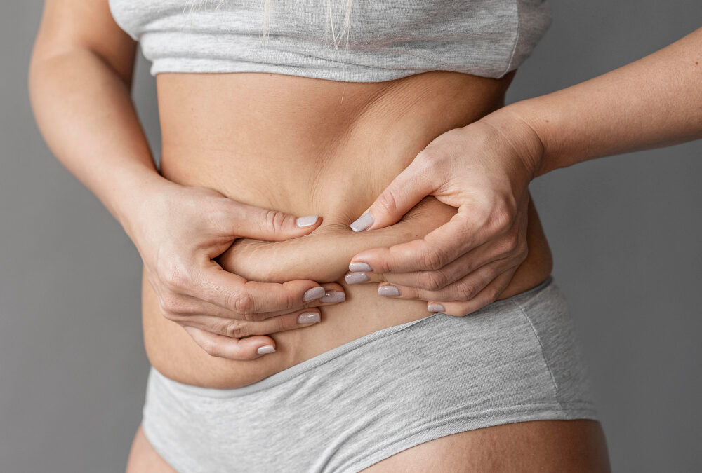 ¿Qué es la Hidrolipoclasia?: Redefiniendo tu Silueta con la Dra. María Fernanda Benavides en Bogotá