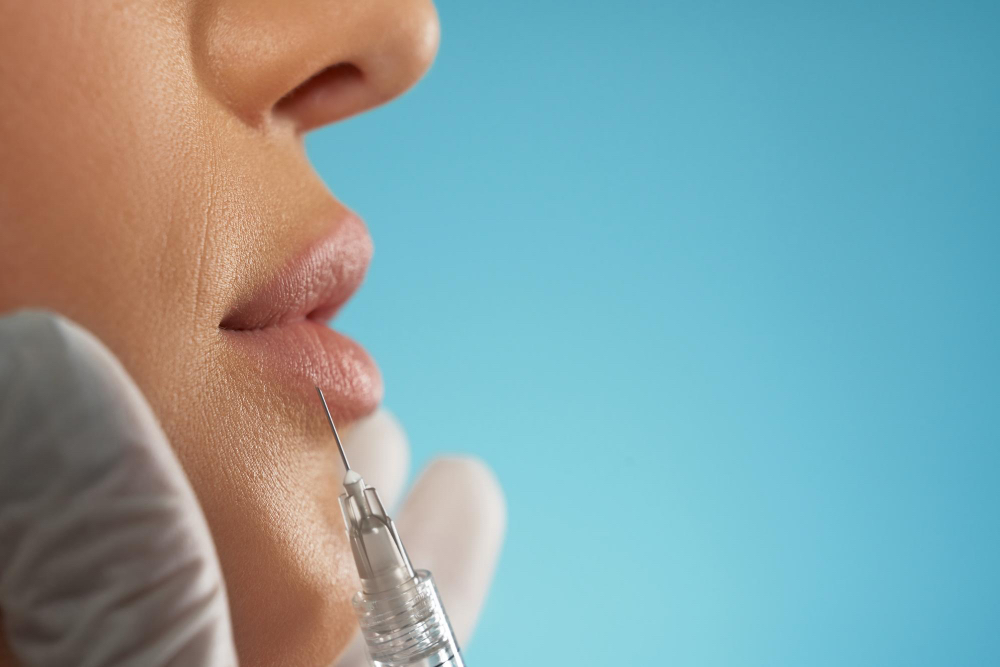 rejuvenecimiento de labios