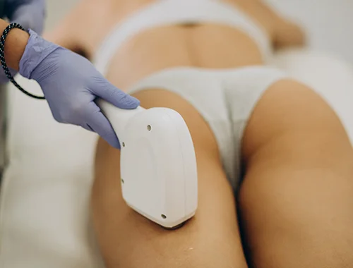 hidrolipoclasia en bogota