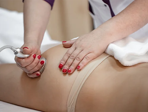 levantamiento de gluteos sin cirugia