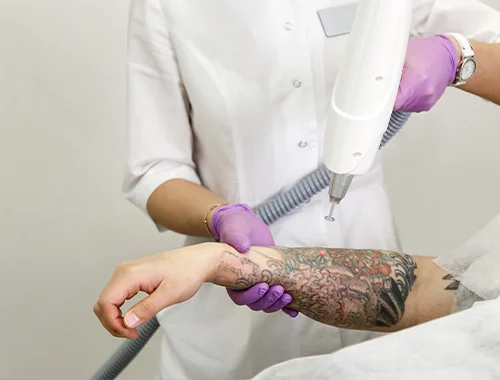 tatoo-3