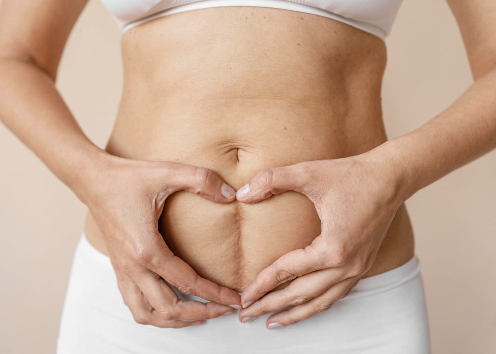 enzimas recombinantes para cicatrices